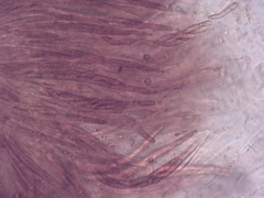 Ruzenia spermoides