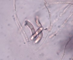 Ruzenia spermoides