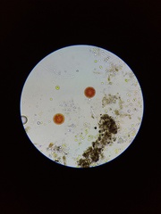 Haematococcus