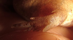 Breviceps