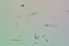 Enchylium coccophorum