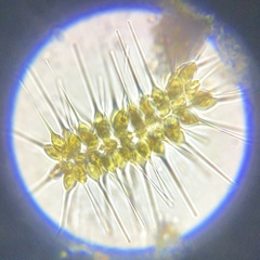 Asterionellopsis