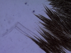 Aphanizomenon flosaquae