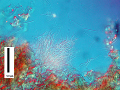 Septoria polygonorum