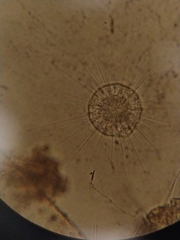 Actinosphaerium