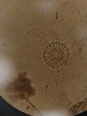 Actinosphaerium