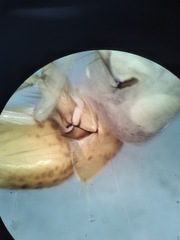 Polycentropus