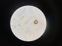 Perichaena corticalis