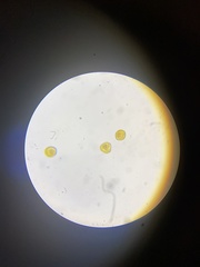 Perichaena corticalis