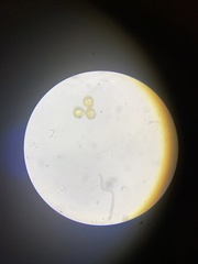 Perichaena corticalis