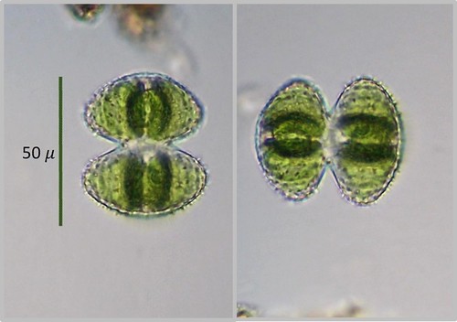 Staurastrum hirsutum
