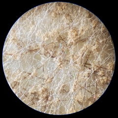Botrytis