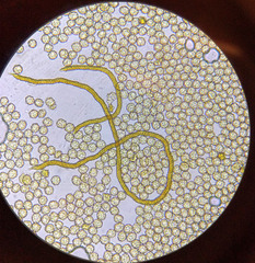 Oligonema persimile