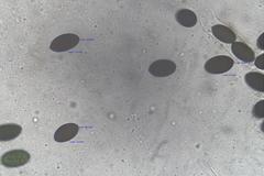 Sordaria macrospora
