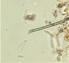 Menispora