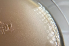 Aureobasidium pullulans