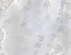 Aureobasidium pullulans