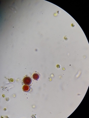 Haematococcus