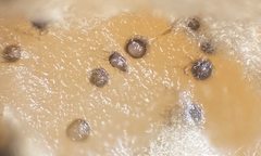 Paraloratospora