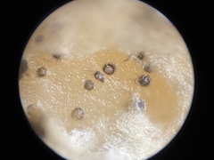 Paraloratospora