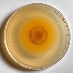 Paraloratospora
