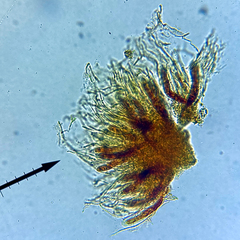 Eopyrenula intermedia