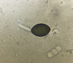 Podospora collapsa