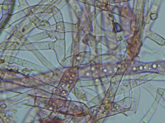 Hypomyces polyporinus