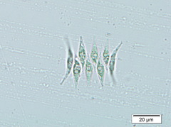 Tetradesmus lagerheimii