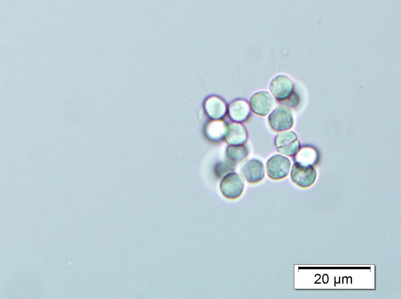 Micractinium quadrisetum