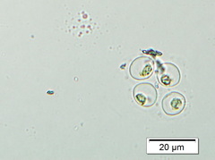 Oocystis