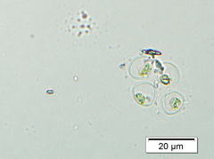Oocystis