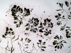 Chaetophora tuberculosa