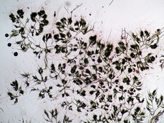 Chaetophora tuberculosa