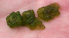 Chaetophora tuberculosa