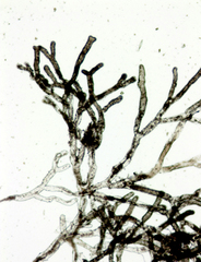 Asterosiphon dichotomus