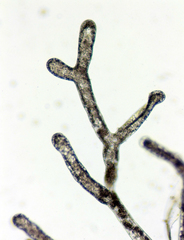 Asterosiphon dichotomus