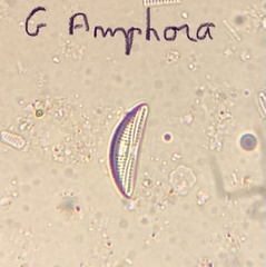 Amphora