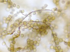 Reticularia jurana