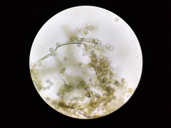Reticularia jurana