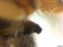 Neoscona kisangani