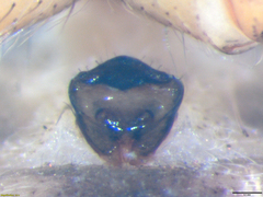 Neoscona kisangani