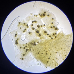 Paraloratospora