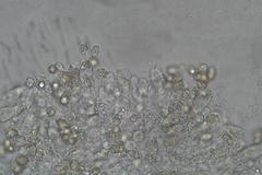 Entoloma melanophthalmum