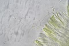 Chlorencoelia versiformis