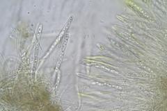 Chlorencoelia versiformis