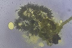 Sordaria macrospora