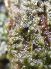 Epigloea bactrospora