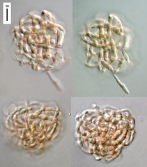 Spirosphaera beverwijkiana