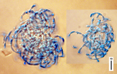 Spirosphaera carici-graminis